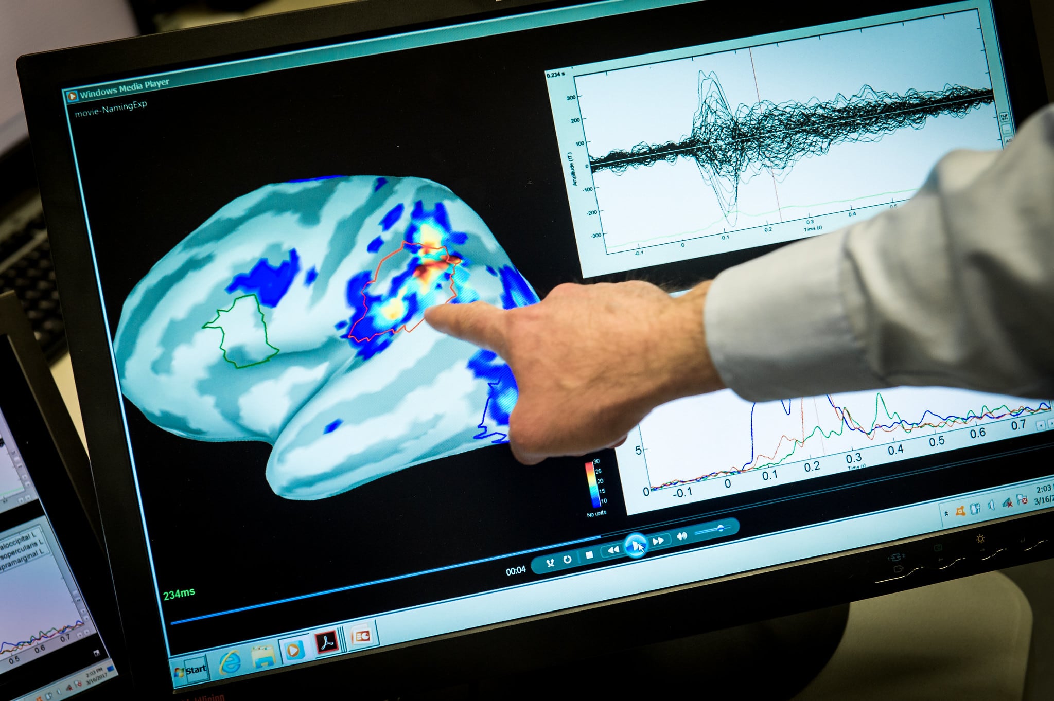 magnetic activity in a brain