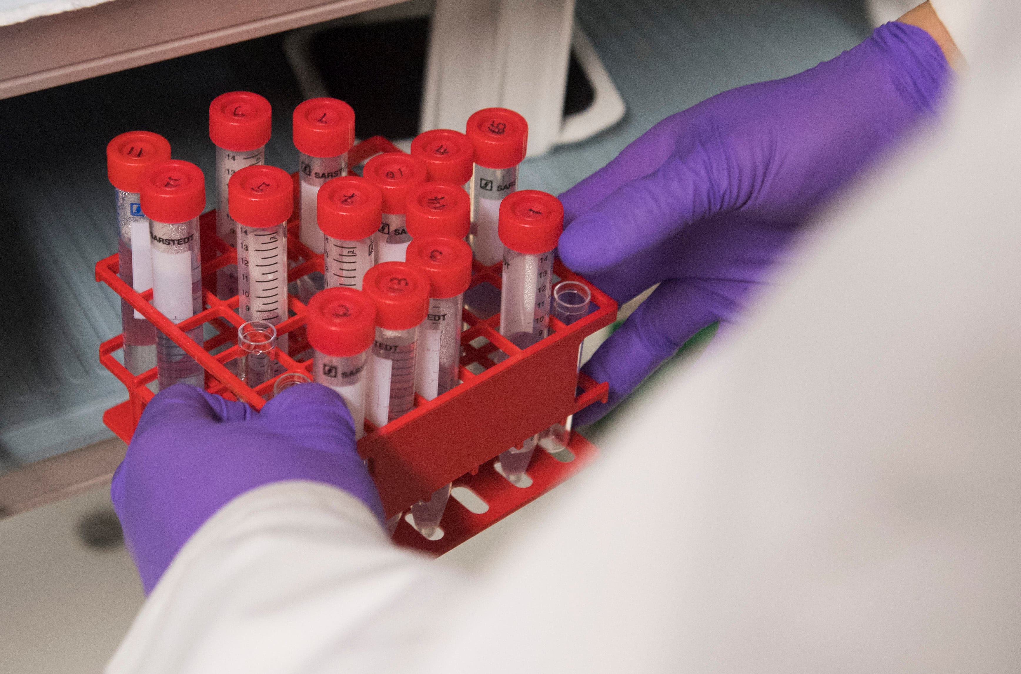 A biologist holds test tubes as he works in a lab at the National Cancer Institute at the National Institutes of Health in Bethesda, Maryland, February 7, 2018.